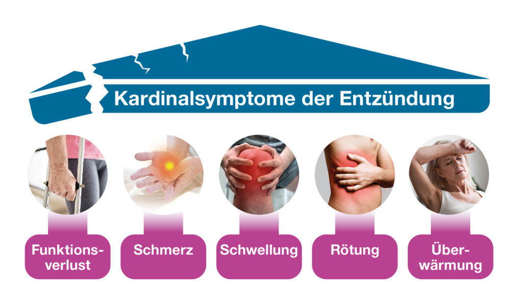 Curcuma oder Kurkuma - In jedem Fall gut bei Entzündungen.